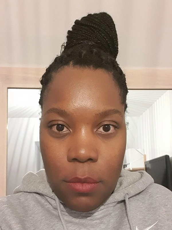 Évolution des yeux de Christelle après 1 mois et demi